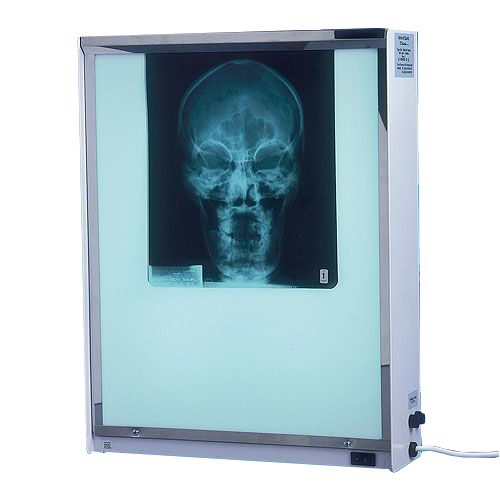Fluorescent X-Ray Viewer - Single